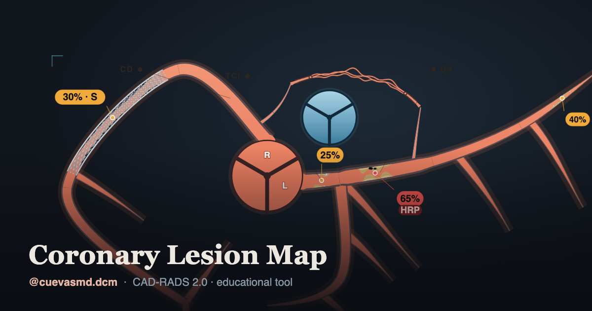 Os Map Rct Rads Coronary Lesion Map — Free CAD-RADS 2.0 Calculator & Diagram